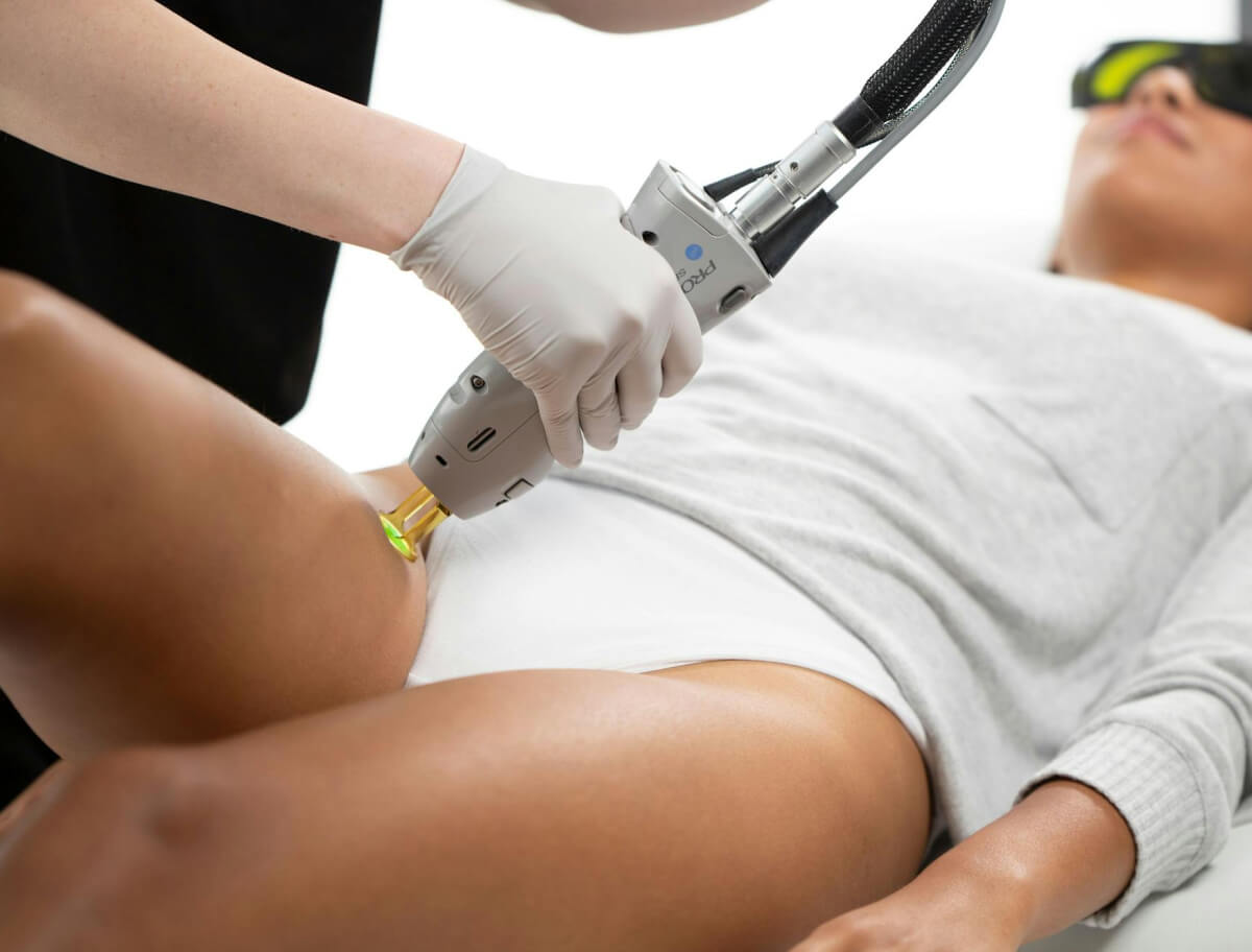 A woman receiving Laser Hair Removal treatment on her legs by a professional wearing protective eyewear and gloves in a modern clinic setting.